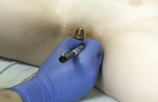 इसके बजाय 1 हाथ की बीपी वीडियो फुल सेक्सी