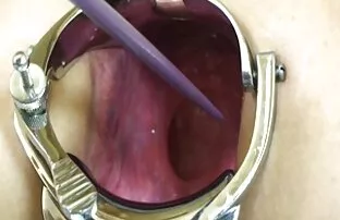 Elmer पत्नी चरम speclum-गुदा!!- kak1 सेक्सी फिल्म हिन्दी मे