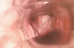 संभोग के दौरान बिल्ली में एल 7 सेक्सी फिल्म भेजो हिंदी में