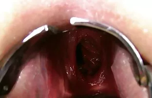 Kinkynikky Prolaps XO specul गुदा हिंदी मूवी पिक्चर सेक्सी